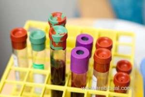 39-new-covid-19-cases-registered-in-bahrain-on-wednesday_kuwait