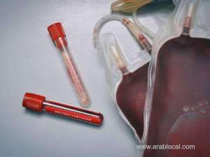 plasma-therapy-for-covid-19_kuwait